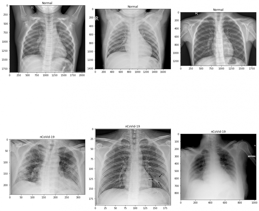 Model output on a chest X-ray